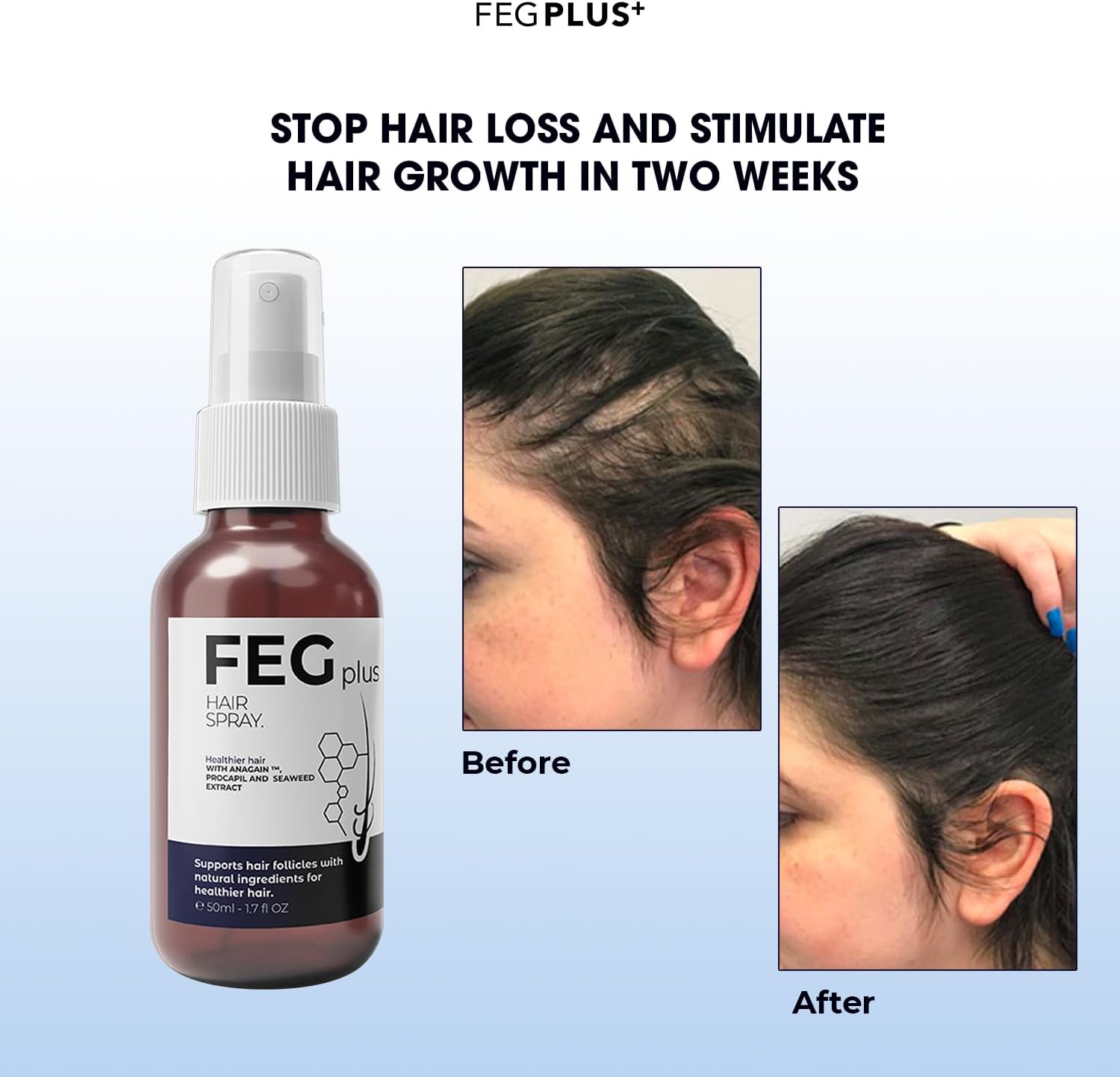 Buy & Thrive™FEG Plus Hair Growth Serum