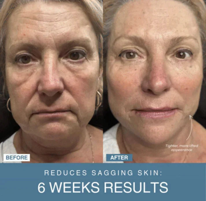 Buy & Thrive™ 7-in-1 LED Anti-Aging/Wrinkle Apparatus