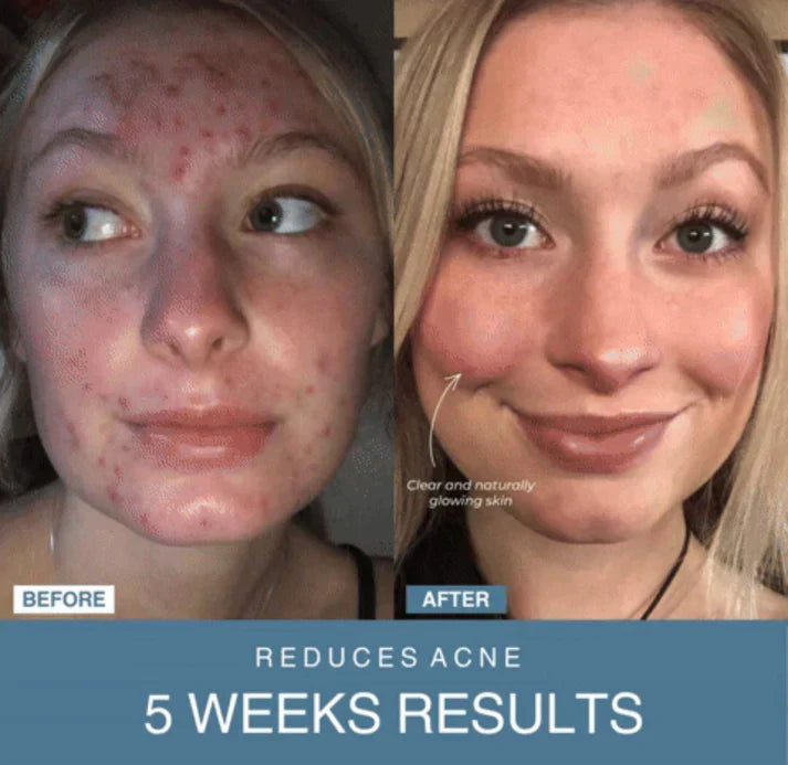 Buy & Thrive™ 7-in-1 LED Anti-Aging/Wrinkle Apparatus